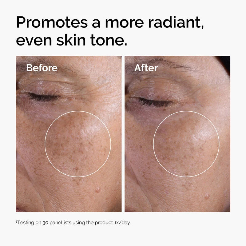 promoting a more radiant, even skin tone.