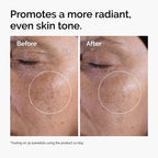 promoting a more radiant, even skin tone.