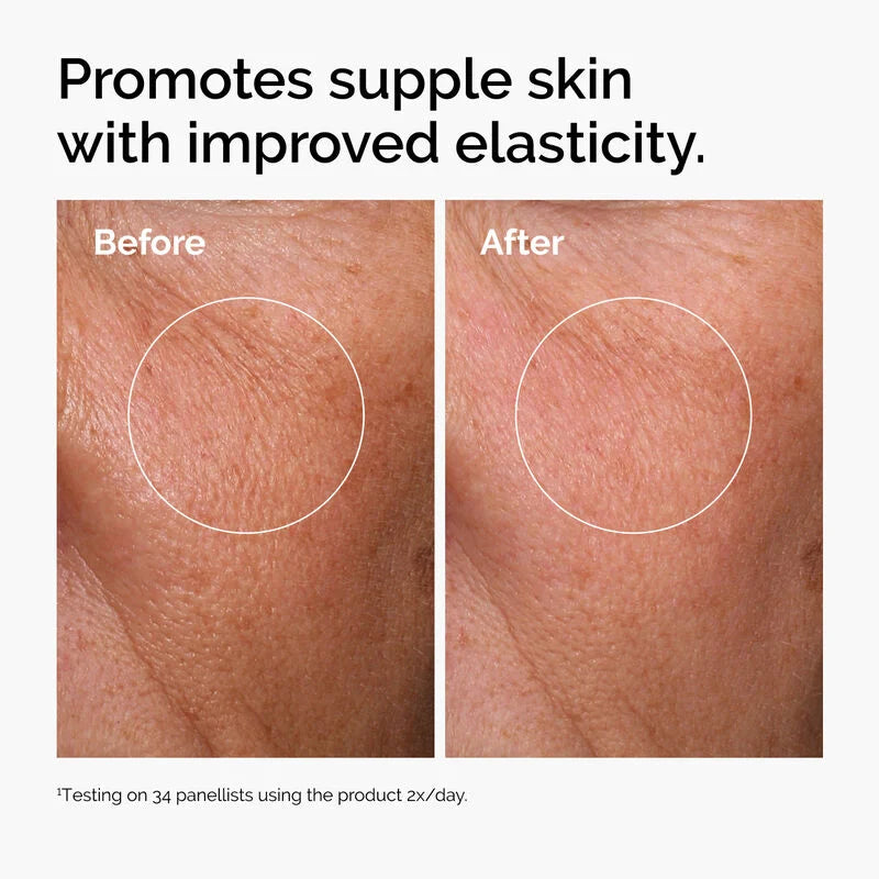 Before and after comparison of skin texture with text promoting suppleness and elasticity.